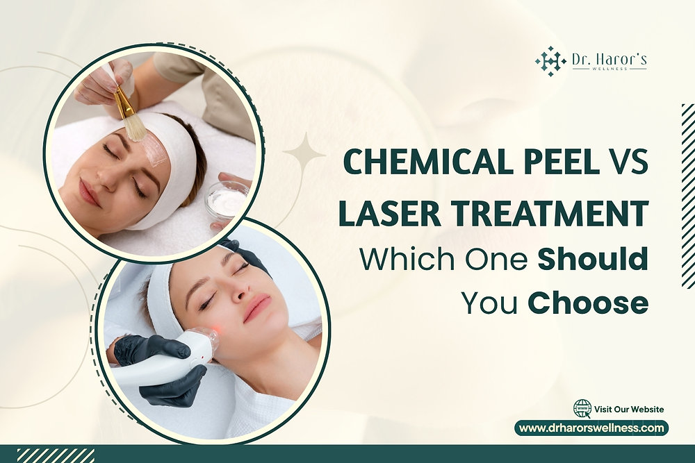 Chemical Peel vs Laser Treatment: Which One Should You Choose