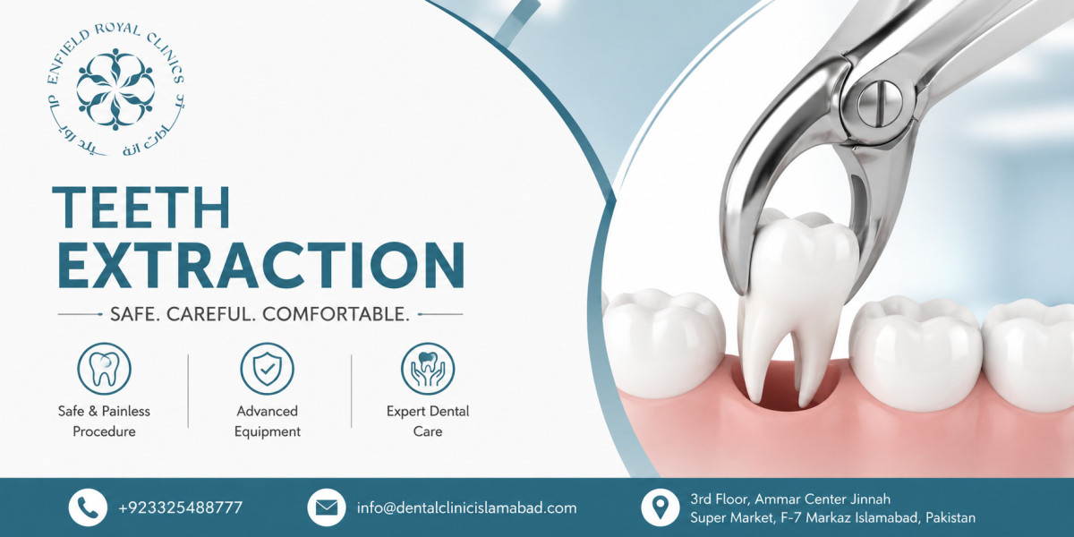 Trusted Clinic for Teeth Extraction in Islamabad