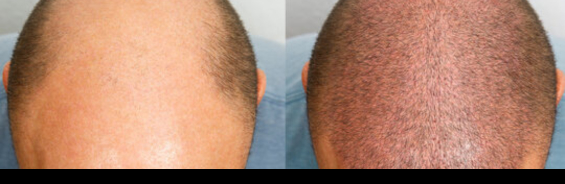 My Hairline Cover Image