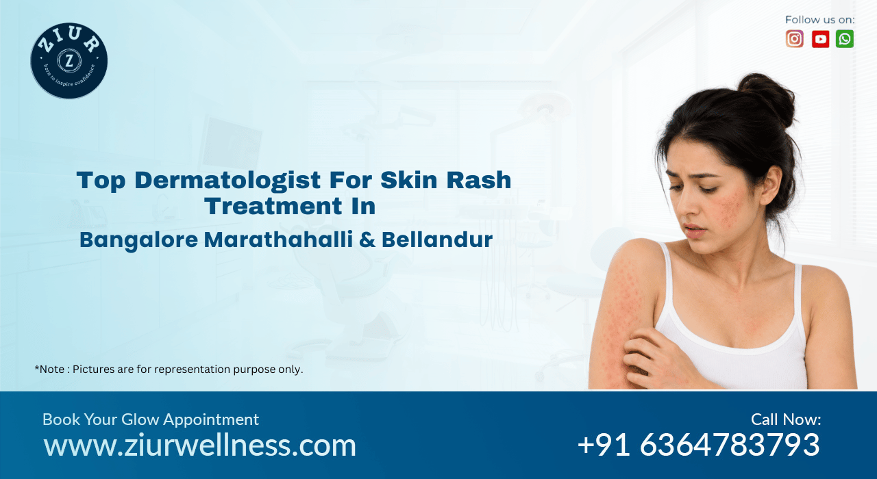 Best Skin Rashes Treatment in Marathahalli, Bangalore