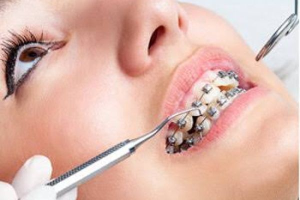 Top 10 Reasons to Choose Orthodontics Tracy for Your Family | MABIAB
