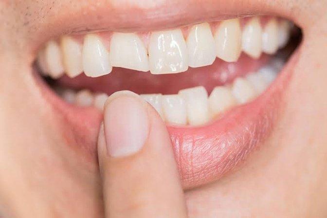 Is a Broken Tooth a Dental Emergency or Can You Wait? | Articles | Elice Dental Care | Gan Jing World - Technology for Humanity | Video & Movie Streaming