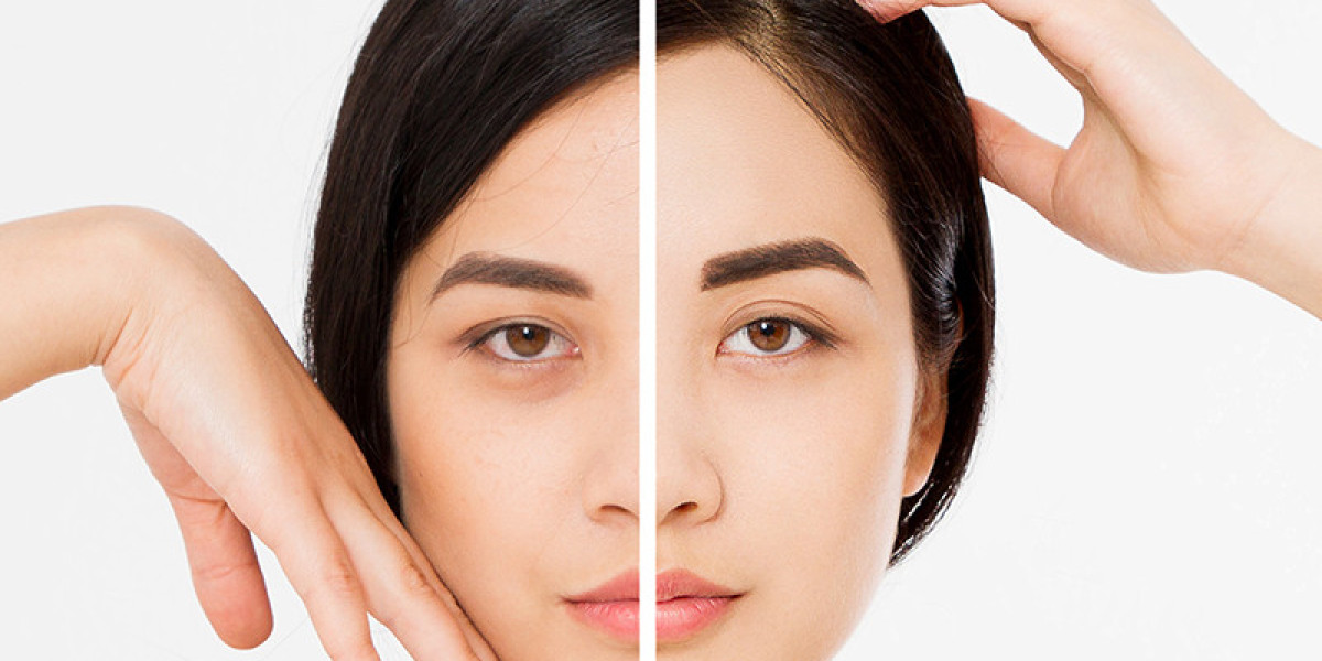 Aesthetic Clinic Abu Dhabi: Real Results Without the Overdone Look