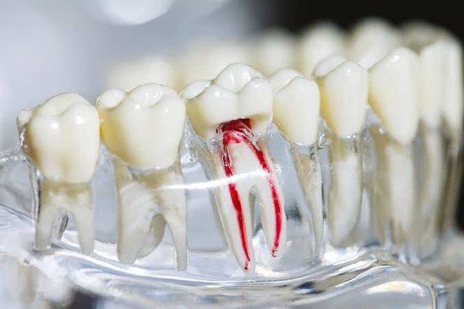 When Is a Root Canal Really Necessary? | Articles | Endodontic Associates of Broward | Gan Jing World - Technology for Humanity | Video & Movie Streaming